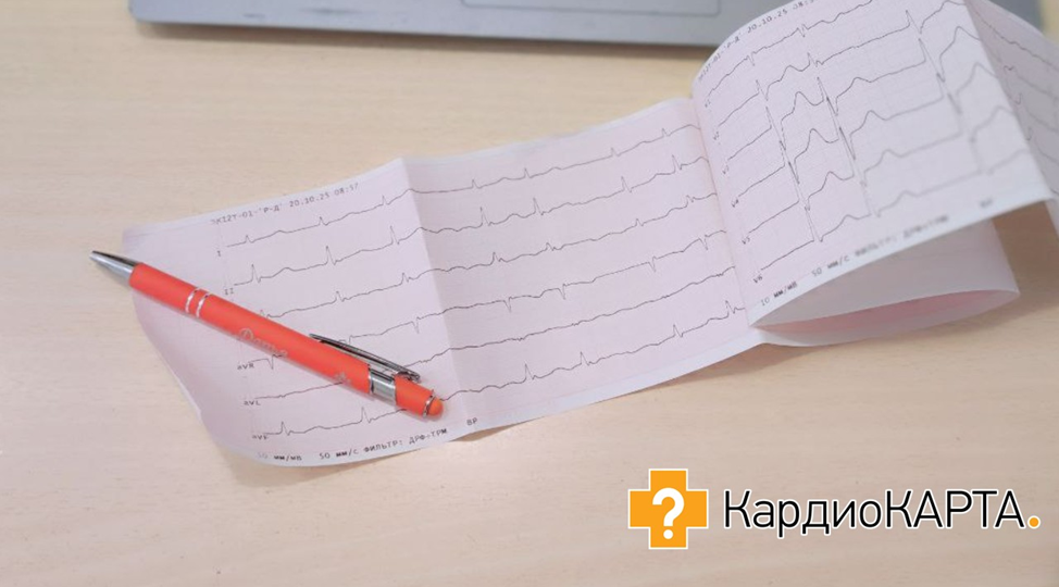 Коварные стороны нарушения ритма сердца: почему неправильное лечение угрожает вашей жизни?