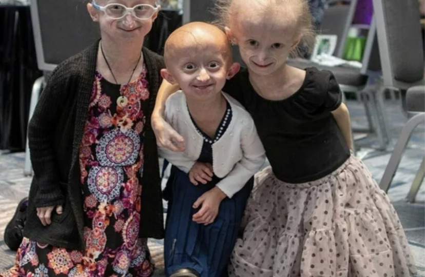 Орфанные заболевания: Самые редкие и загадочные патологии человечества