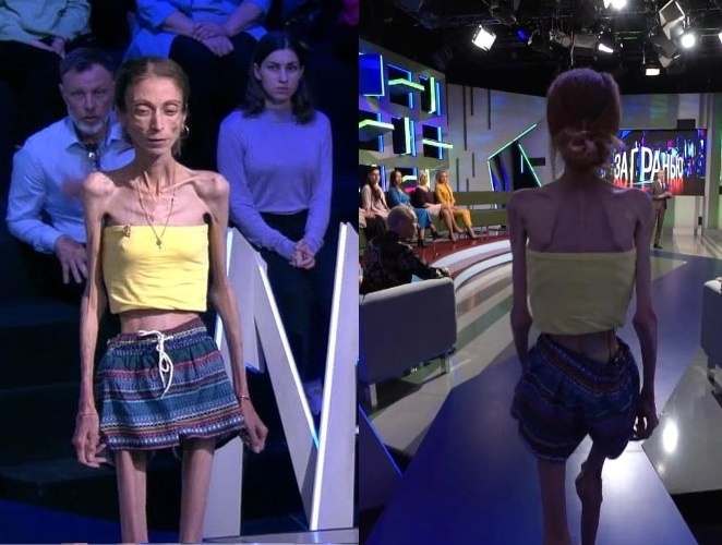    Яна Боброва до начала борьбы с весом: здоровая и полная жизни.