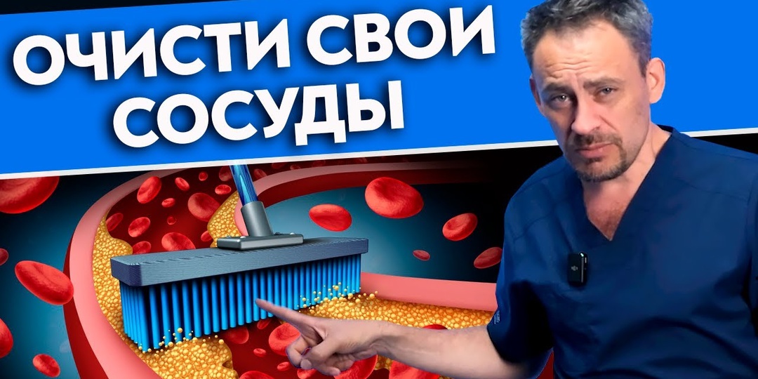 Как понять, что сосуды забиты