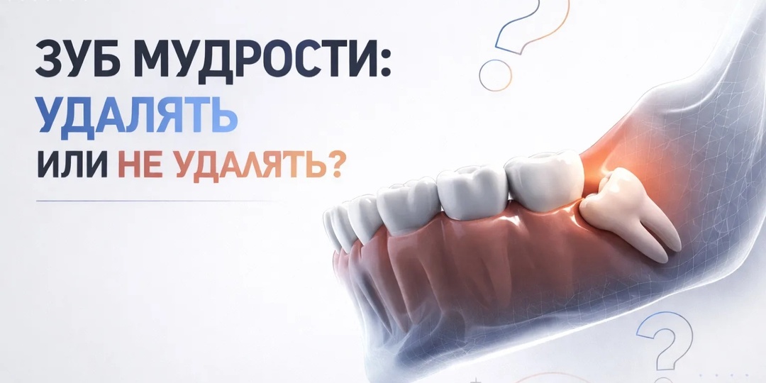 Зуб мудрости: удалять или не удалять?
