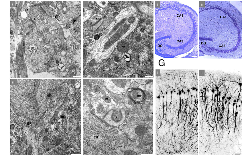 Работа нейронов восстанавливается после криоконсервации