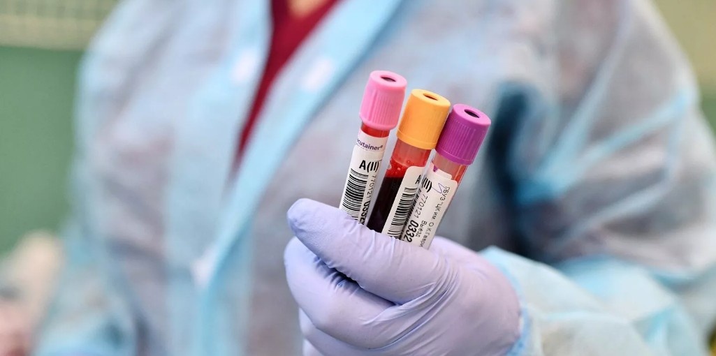 Учёные обнаружили возможную связь между низким уровнем CD4-клеток и риском рака шейки матки у женщин с ВИЧ