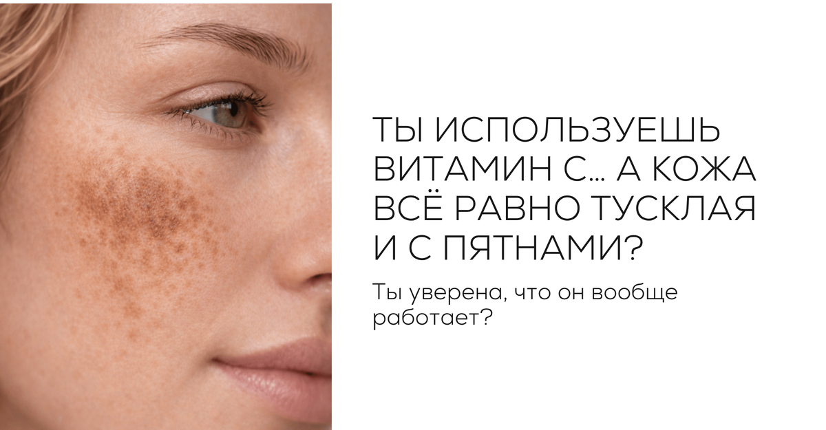 Ты используешь витамин С… а кожа всё равно тусклая и с пятнами. Ты уверена, что он вообще работает?
