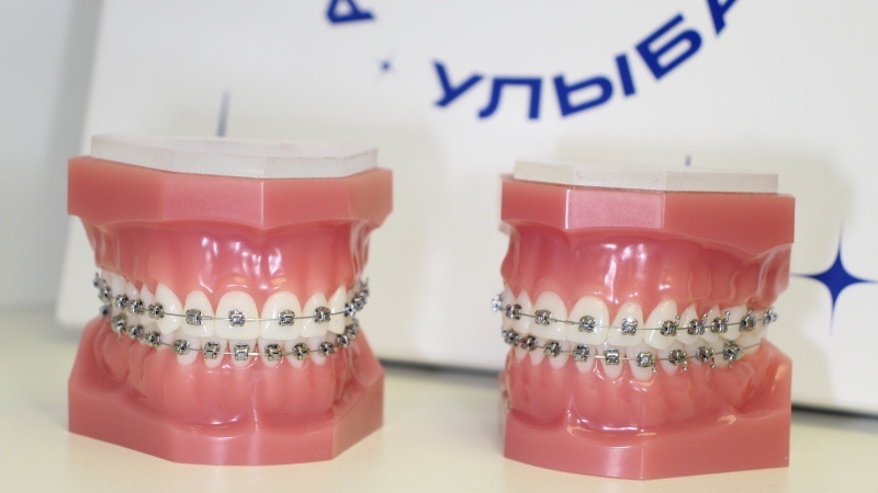 Стоматология Премоляр