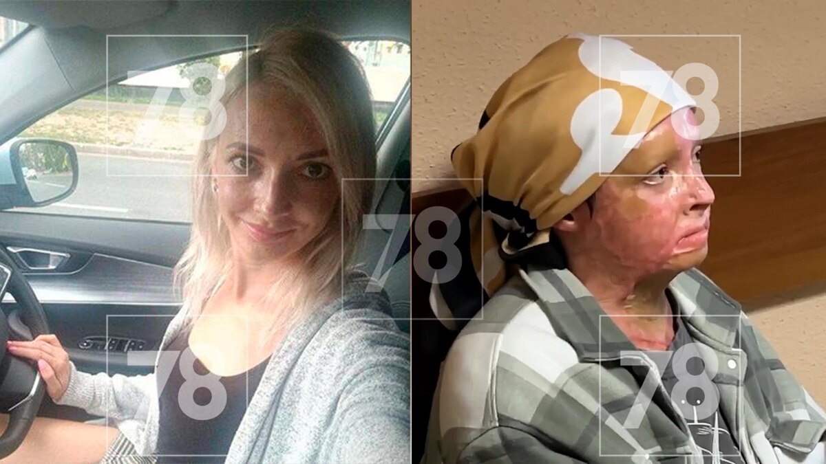 Инна до и после / Фото: 78.ru