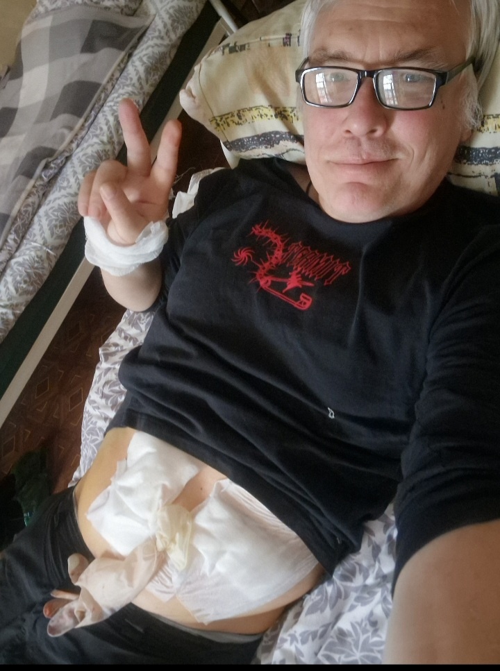 Нет, это не презерватив я снять забыл! 😆😆😆                                Это ноу-хау Мечки: сборник с дренажа. 🤗