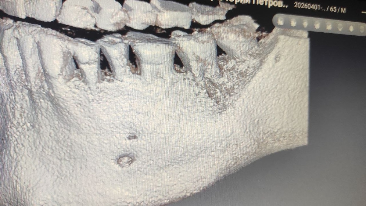 На зуб могу посмотреть только на фото