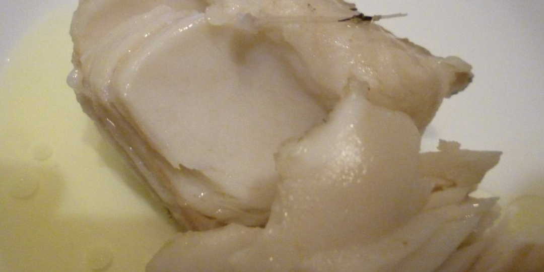 Боль без желчного пузыря: мнение врачей