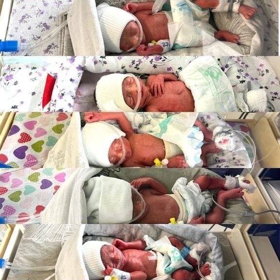 Фото : Etilaatroz(Етилаатроз)