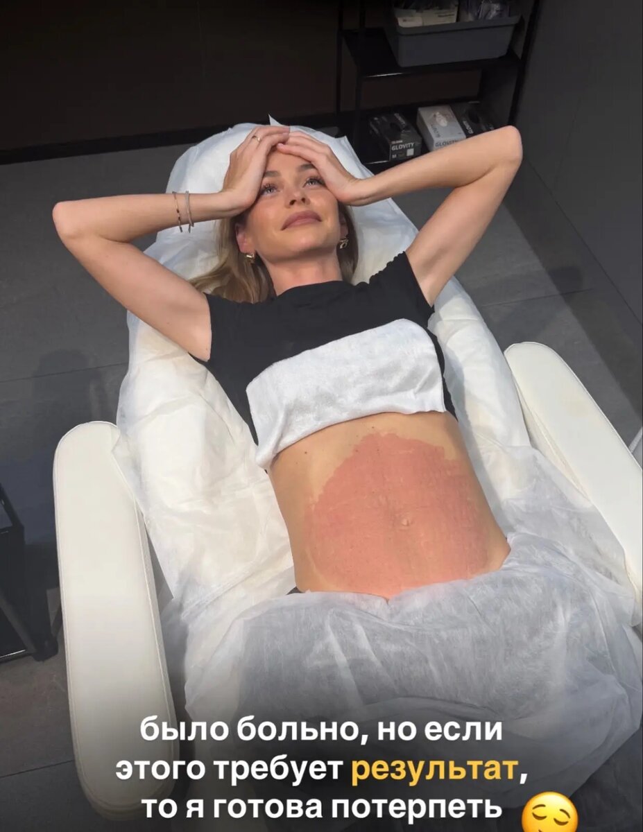    Анна Хилькевич готова терпеть боль ради плоского животикаСоцсети Анны Хилькевич