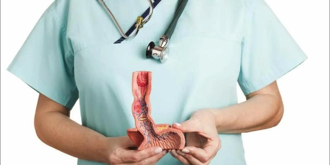 🟠 Изжога, которая убивает: как не пропустить рак пищевода