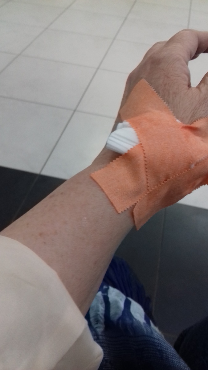 Моя рука после введения  лекарства в вену в ФМБА.