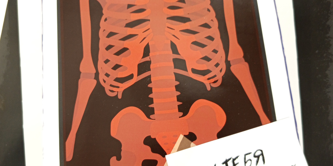 Ошибки рентгенологов