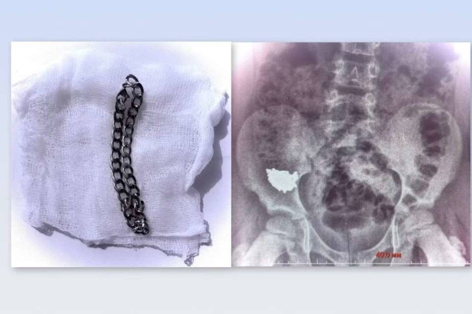    Фото: Обозреватель.Врн.