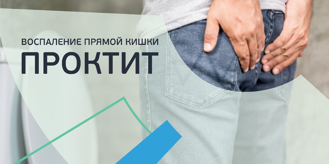 Проктит и его последствия. Почему нельзя тянуть с визитом к врачу
