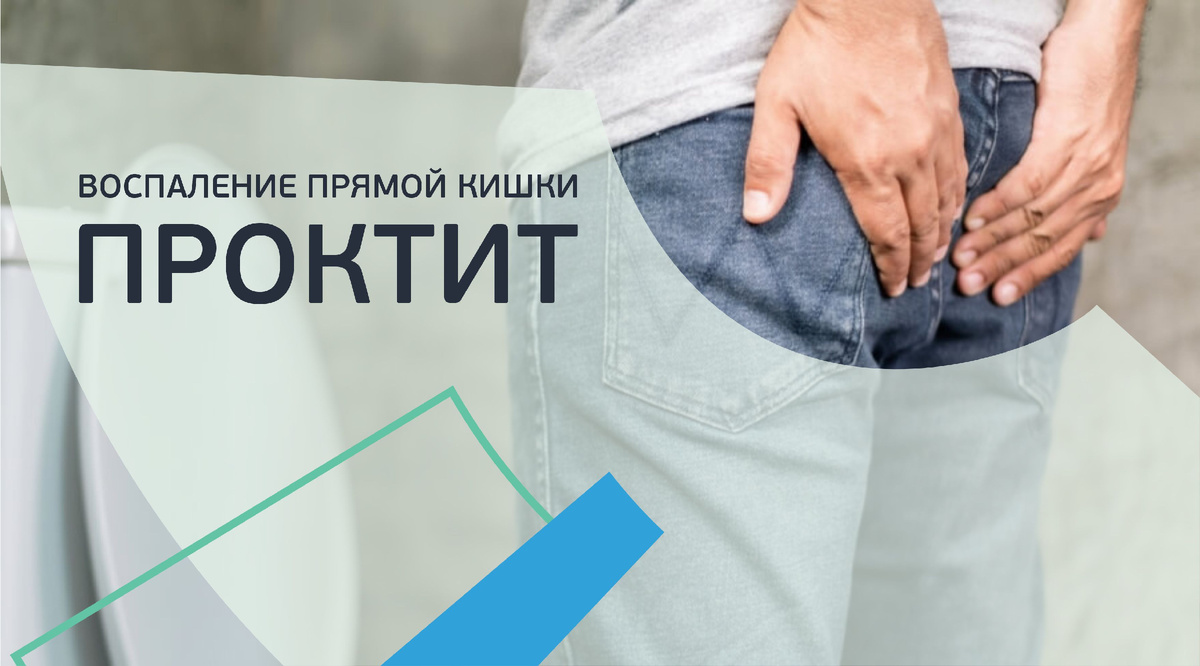 Проктит и его последствия. Почему нельзя тянуть с визитом к врачу
