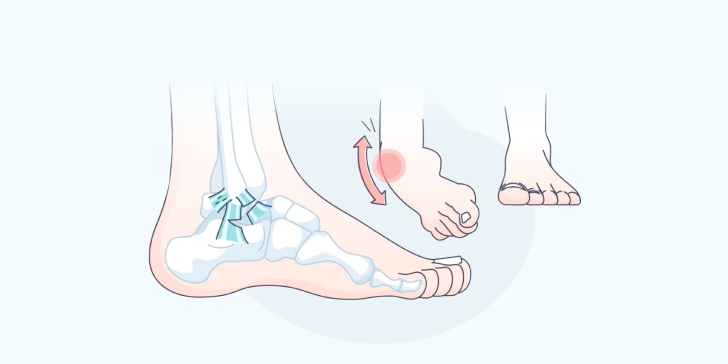 Травма голеностопа у ребенка. Какая тактика лечения?