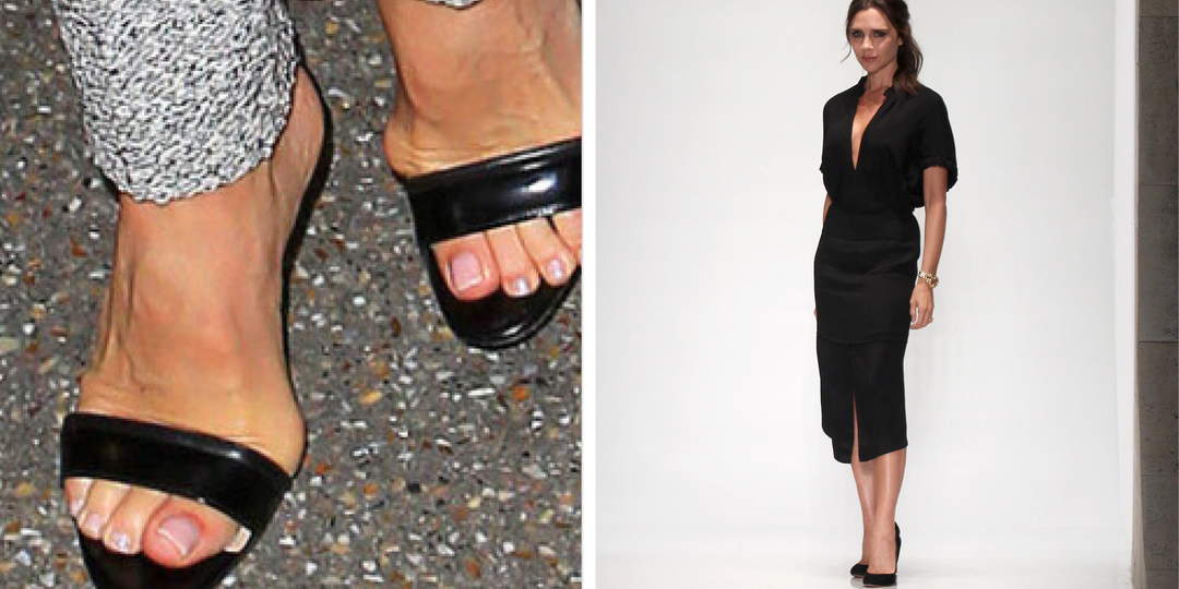 Что со стопами у Виктории Бекхэм, Наоми Кэмпбелл, Кейт Мосс и других икон стиля