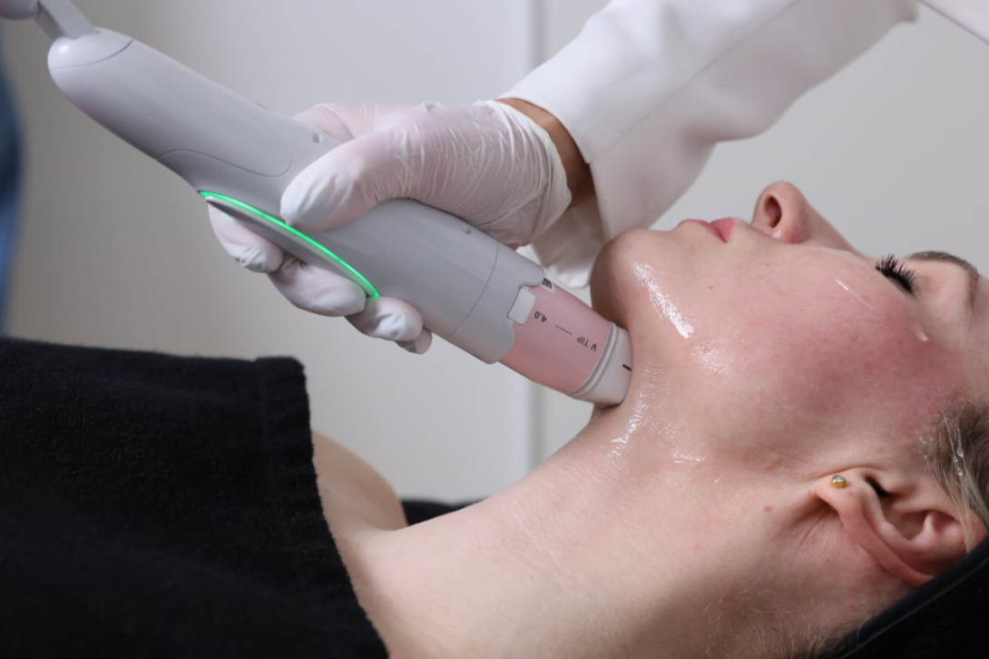 Монополярный RF — «фитнес для кожи»
