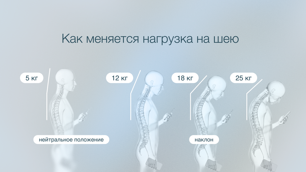 Как меняется нагрузка на шею