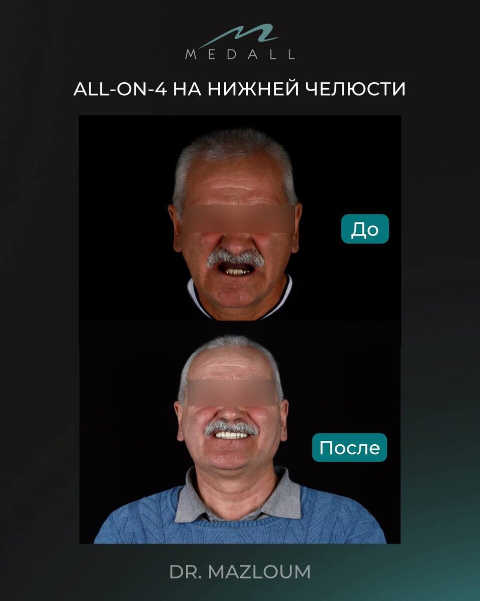 -2-2