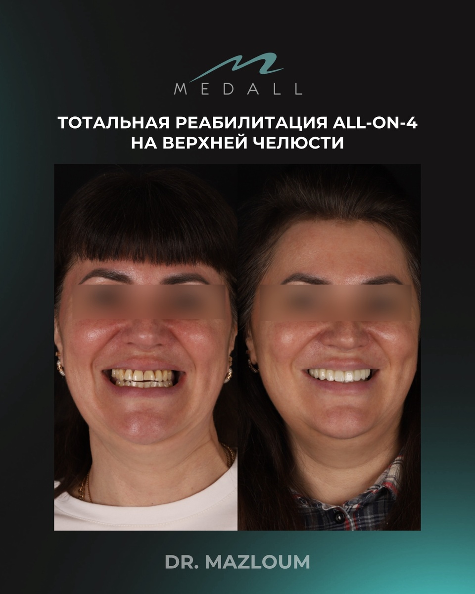 -2-3