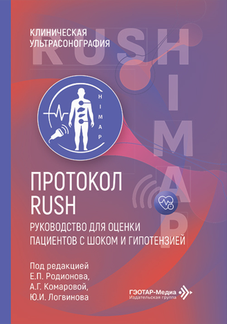 RUSH-протокол. Руководство для оценки пациентов с шоком и гипотензией