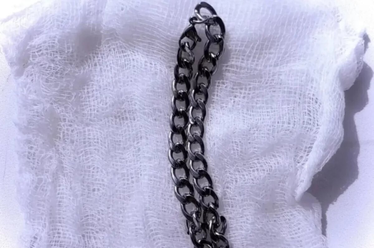    Мальчик из Воронежа проглотил 20-сантиметровую цепочку