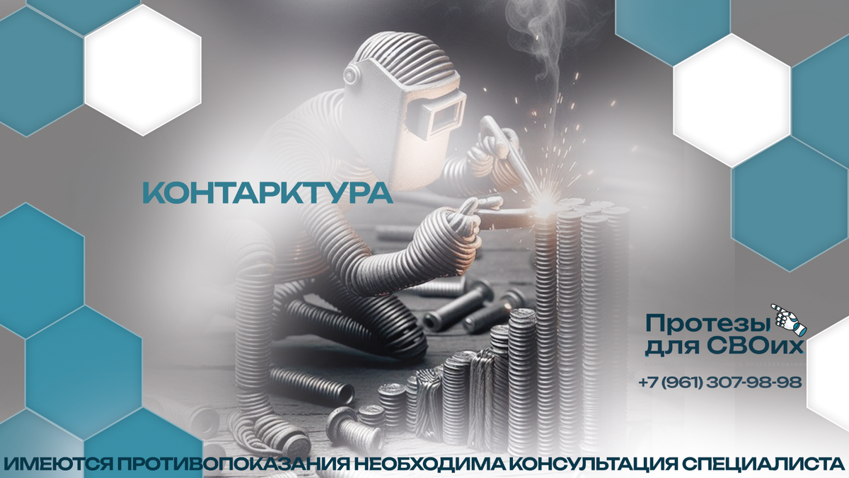 Ростов-на-Дону, ул. Таганрогская, 33, “Протезы для СВОих”