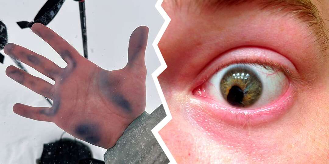 17 историй в фотографиях, где тело людей менялось так необычно, что хочется рассмотреть детали