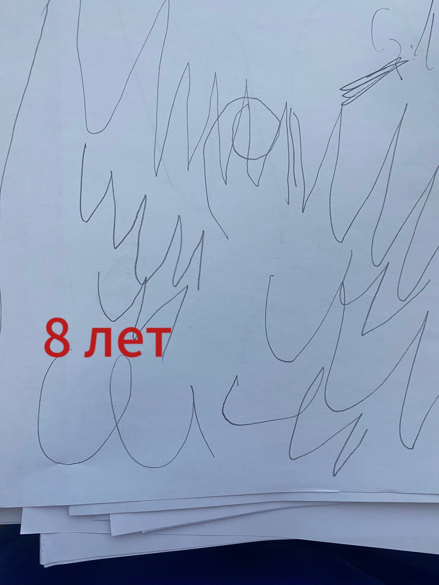 Тест «Рисунок человека» , ребенок с умственной отсталостью.