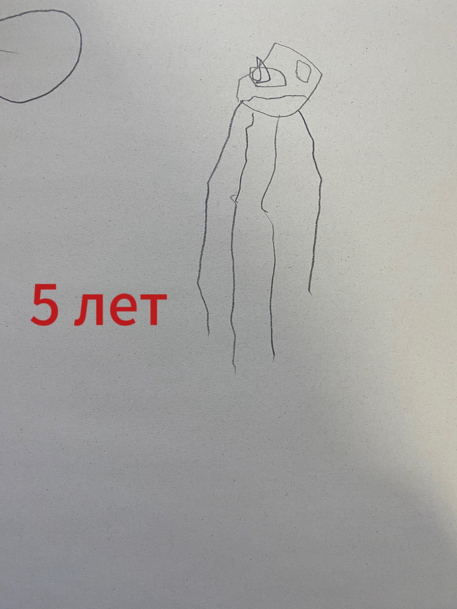 Тест «Рисунок человека», ребенок с моторной алалией.