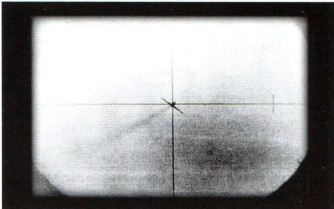 Ответный ход