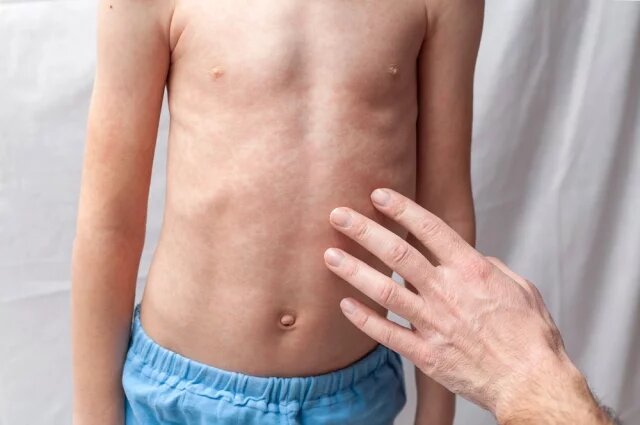    О чём говорит внезапно появившаяся сыпь у ребёнка?