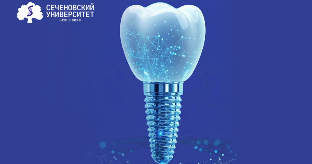 Ученые Сеченовского Университета выяснили, как свести к минимуму риск отторжения зубных имплантов
