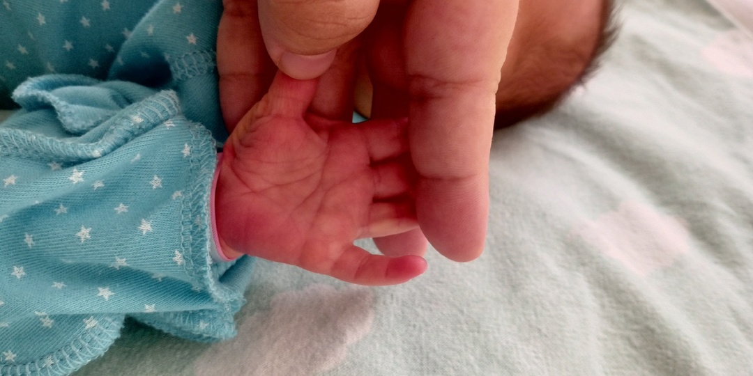 О чем рассказали руки новорожденной малышки. Из рубрики "Вопрос - ответ".