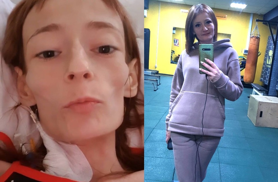 Болезнь просто съела девушку за полгода. Фото: личный архив Виктории Чувашиной