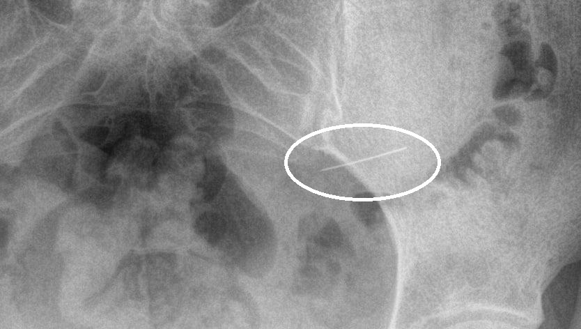    Министерство здравоохранения МО
