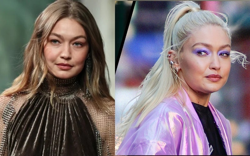 "Бульдожьи щёчки" и 9 способов их избежать. Что может вызвать сию "красоту"