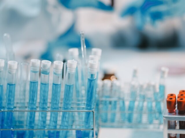    Фото: 123RF.com/armmypicca