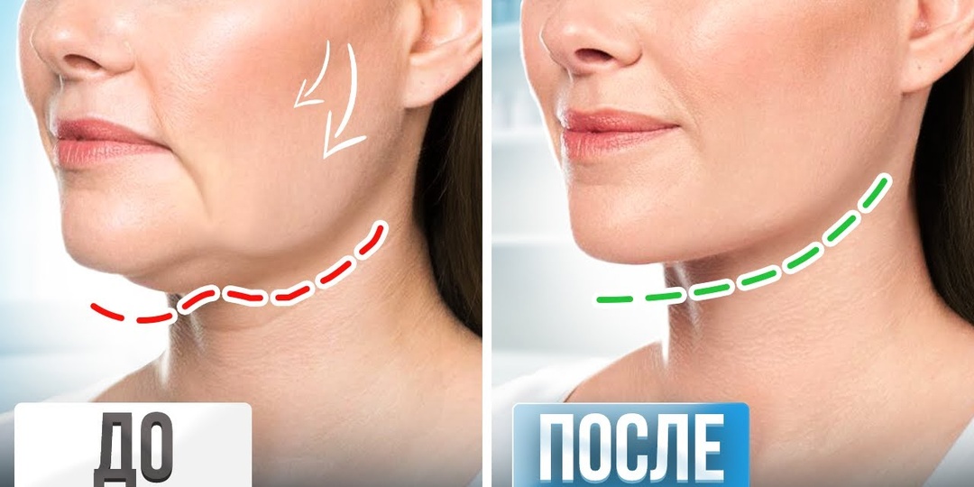 Три вещи, которые вы не знали о брылях — и что с этим можно сделать без иголок и скальпеля