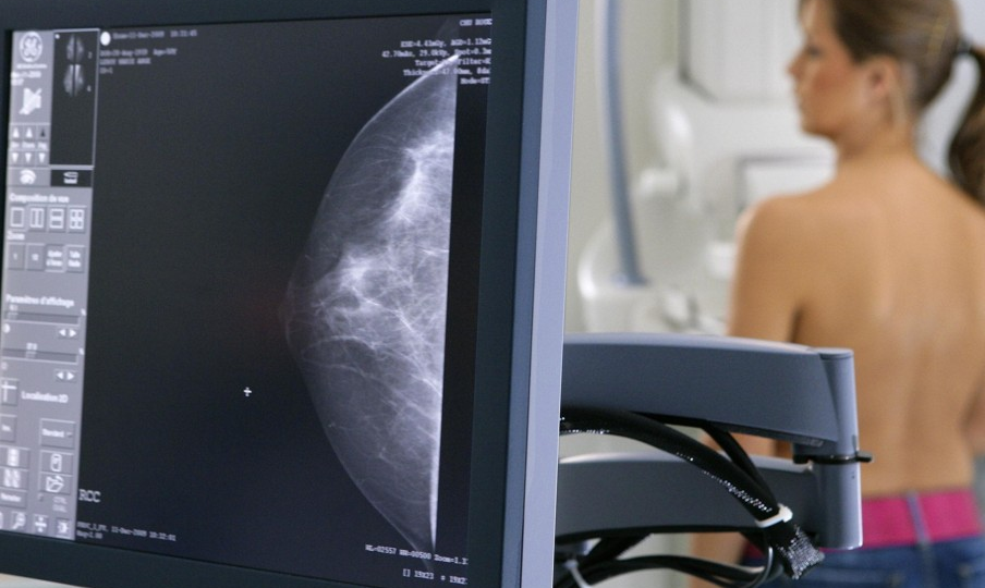 Классификация BI-RADS: как расшифровать результаты маммографии и УЗИ молочной железы?