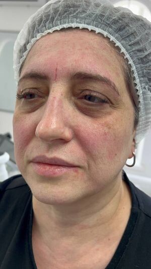 Фото до процедуры