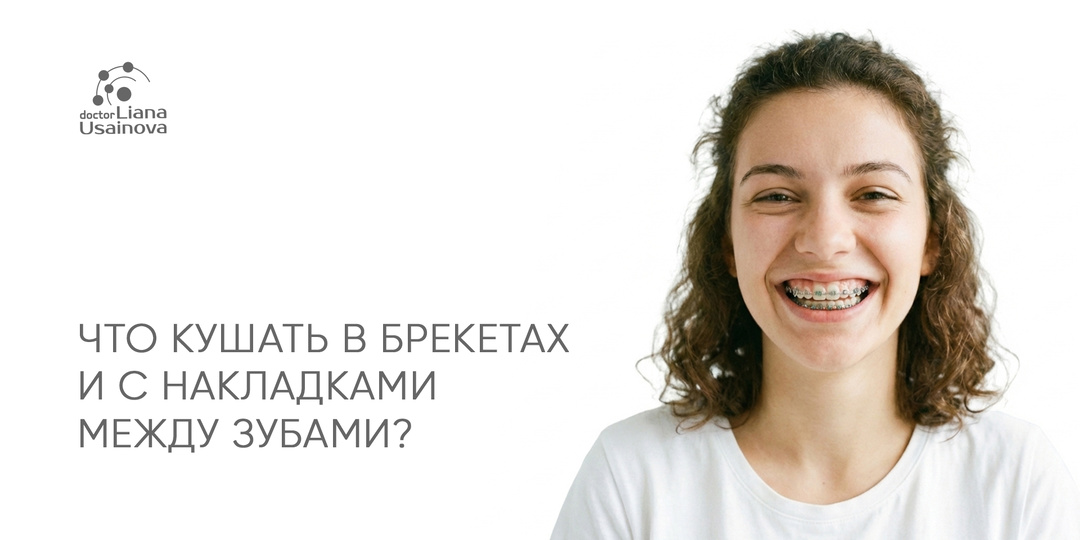 Что кушать в брекетах и с накладками между зубами? Рассказывает доктор Эндокринолог.