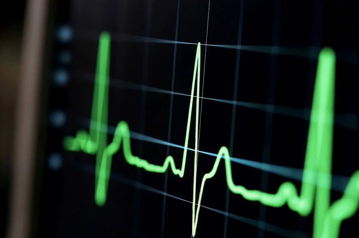    Врачи с Камчатки вернули к жизни пенсионера, отбивая ритм по телефону