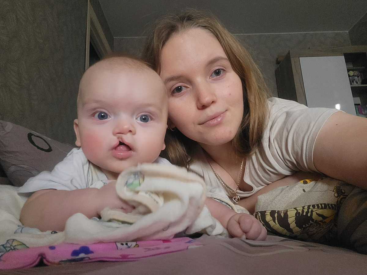 У нас родился желанный и долгожданный сын. Из-за моих проблем со здоровьем боялись осложнений с вынашиванием беременности. Оказалось, что сложности будут не со мной, а с малышом.