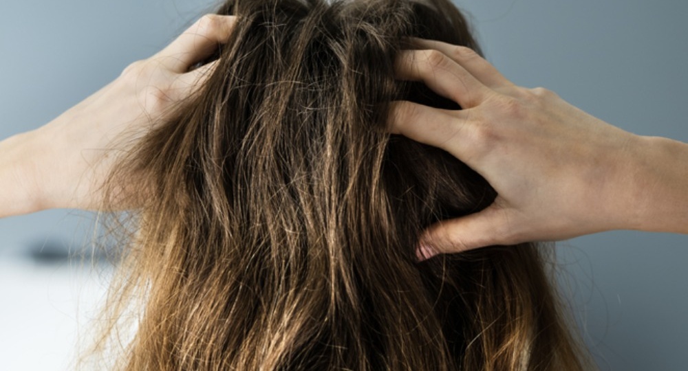 Почему чешется кожа головы: 12 причин и что с этим делать