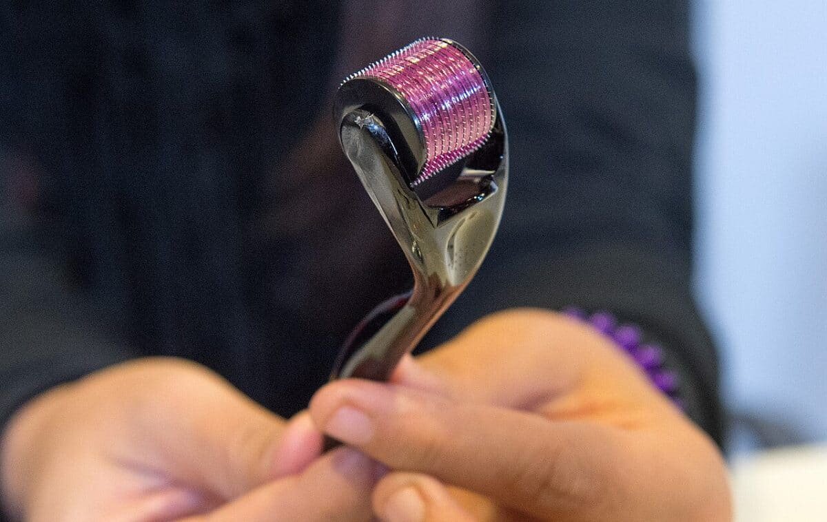    Мезороллер / © Gobierno de Castilla-La Mancha, Wikipedia