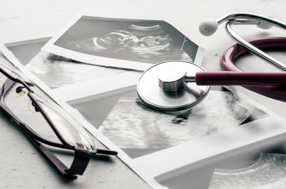    Shutterstock/FOTODOM